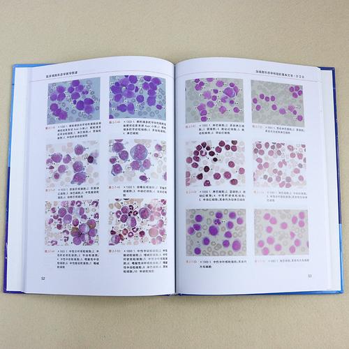 王永伦 细胞形态学图谱 细胞学 细胞学图谱 造血检验 血细胞图谱 血液