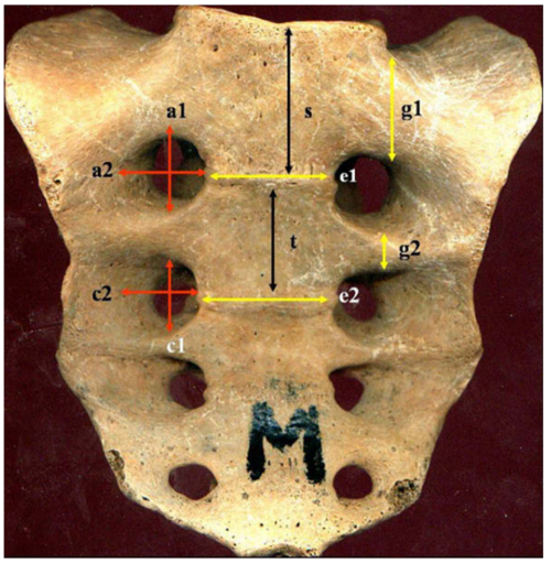 a1:第1骶孔前面观高度;a2:第1骶孔前面观宽度;c1:第2骶孔前面观高度