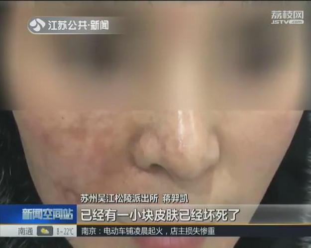 女子美容院打玻尿酸致毁容?