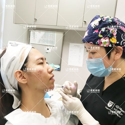 注射下巴 放松颏肌 瘦脸