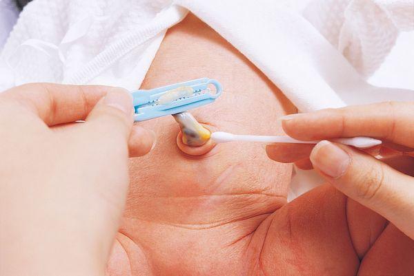 新生儿肚脐护理的方法 护理的时候需要注意什么