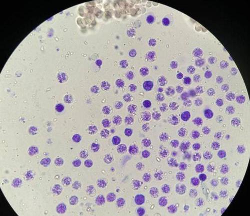 发现大量聚集状的网织红细胞,这说明了这只猫属于再生性贫血,造血功能