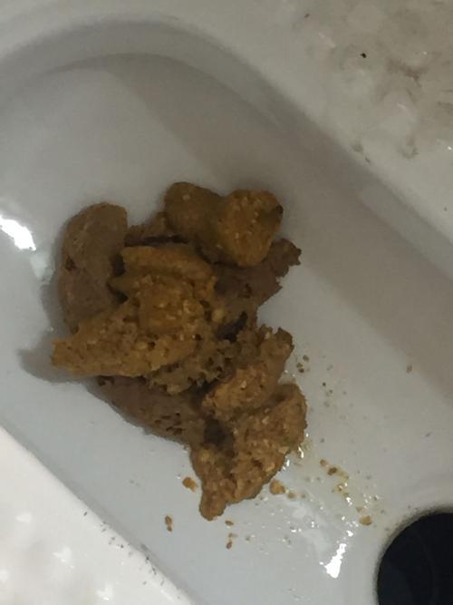 孕妇拉这样的大便正常吗