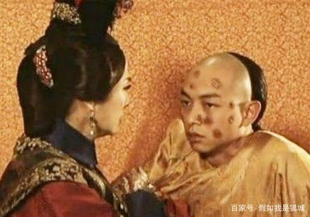 宋朝就能治疗天花,为何到清朝有大量皇子死于天花,是中医没落?