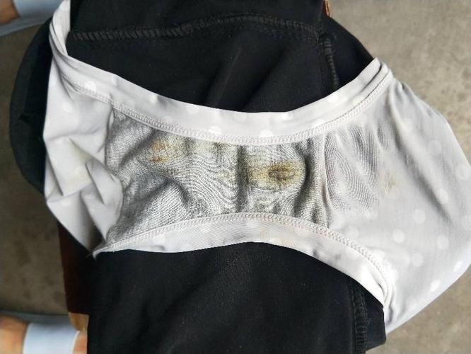 每天更换内裤时候就发现内裤上面有异物