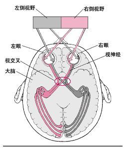 压迫性视神经病变