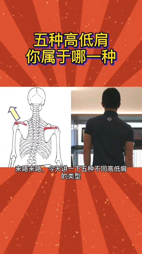 五种不同的高低肩,看看你是哪一种_极优怎么样_运动健身_健身减肥