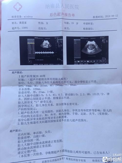 怀孕35周 3天脐带绕颈一周有事吗?
