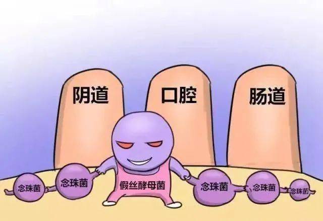 你的霉菌性阴道炎,为何总治不彻底?