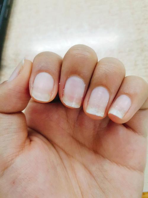 长期做美甲,洗完澡后感觉指甲特别薄怎么办