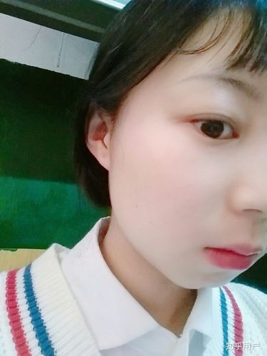 没错我就是苹果下巴加下巴后缩,用嘴呼吸导致的,很苦恼,在这里提醒