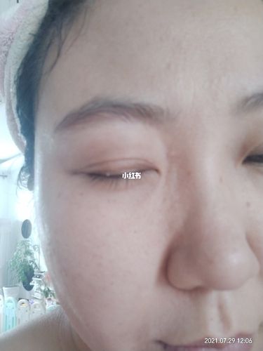 求助,眼皮靠近睫毛根部长了个小颗粒_睫毛_老年人_美妆_护肤_护肤其他