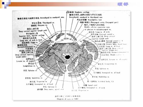 人体解剖断层-颈部(断面).ppt