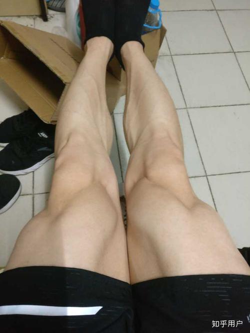 腿不直是什么原因(传说中的xo型)?有什么补救措施吗?