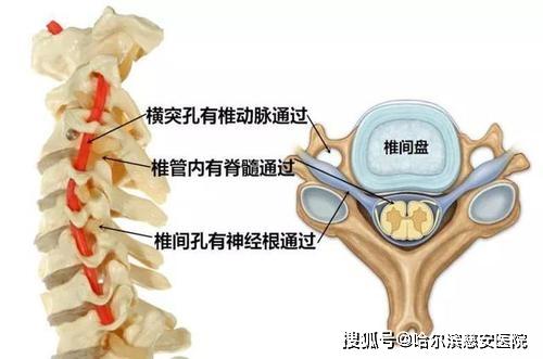 科普神经根型颈椎病