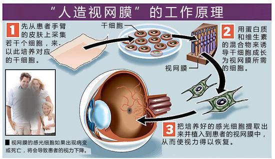 核心提示:日本理化学研究所公布的"人工视网膜"照片:左图浮在试管中的
