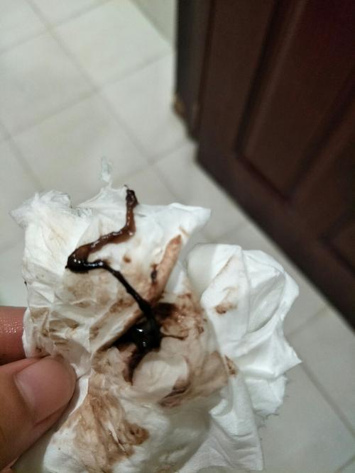 我怀孕七周,今天上厕所有这个东西,褐色的,是先兆流产