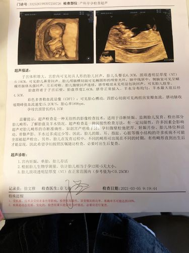 nt看男女_nt检查_女宝宝_母婴_孕产经验