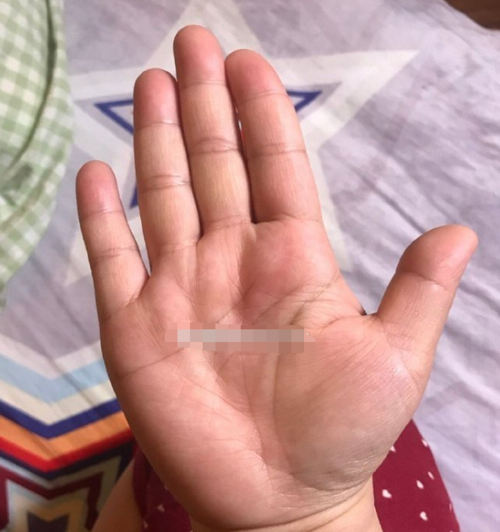 感情线与智慧线呈锁链状专注力不强烂桃花比较多