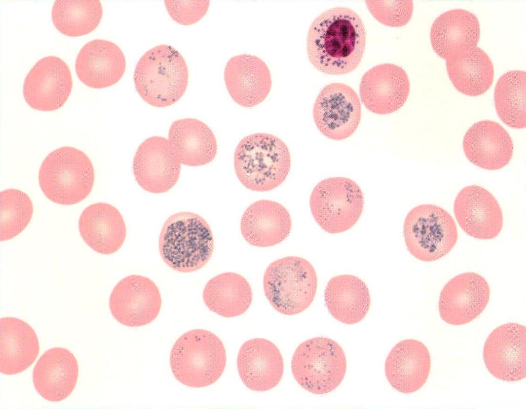 (图) 网织红细胞