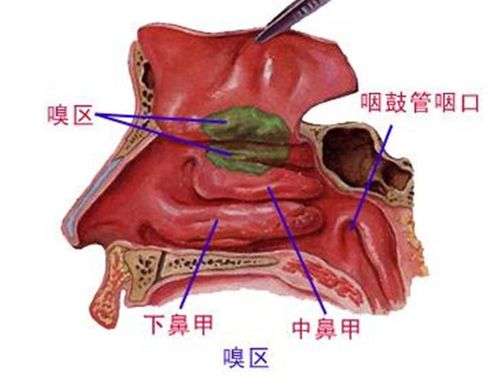 鼻炎 鼻甲肥大 华康医院帮你解决