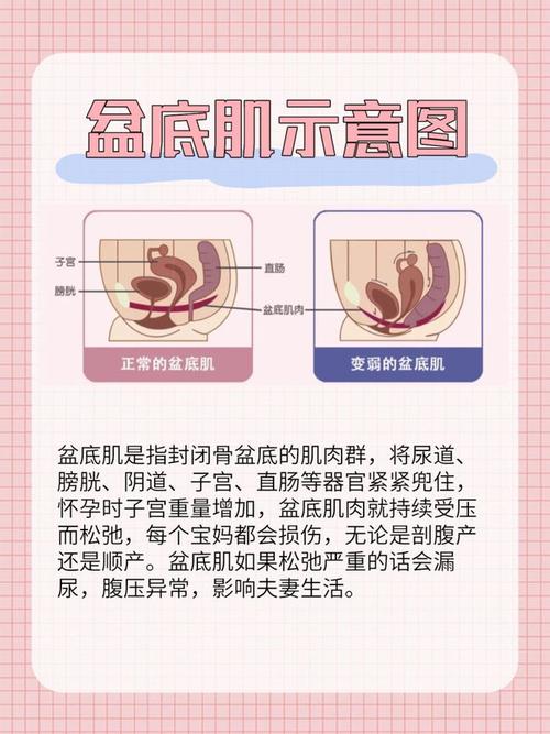 产后修复全攻略盆底肌腹直肌骨盆肌