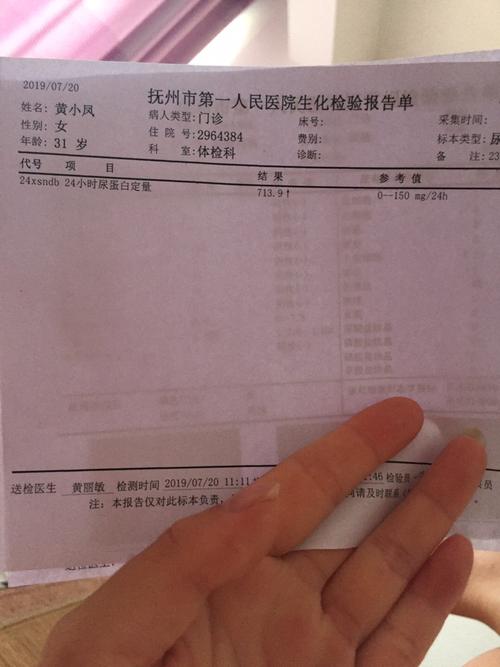 大家有做过24小时尿蛋白定量的检查吗