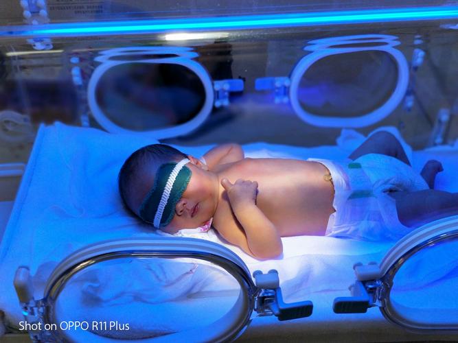 在辽阳第三人民医院用蓝光照射去黄疸.