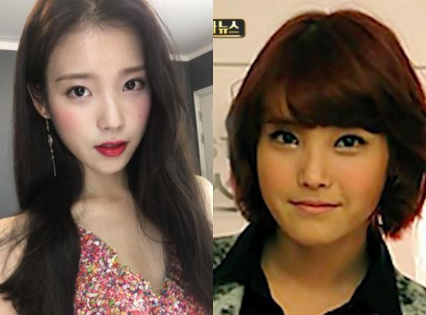 iu刚出道的脸型较圆润,曾被怀疑动「正颚手术」.(图/翻摄自mbc)