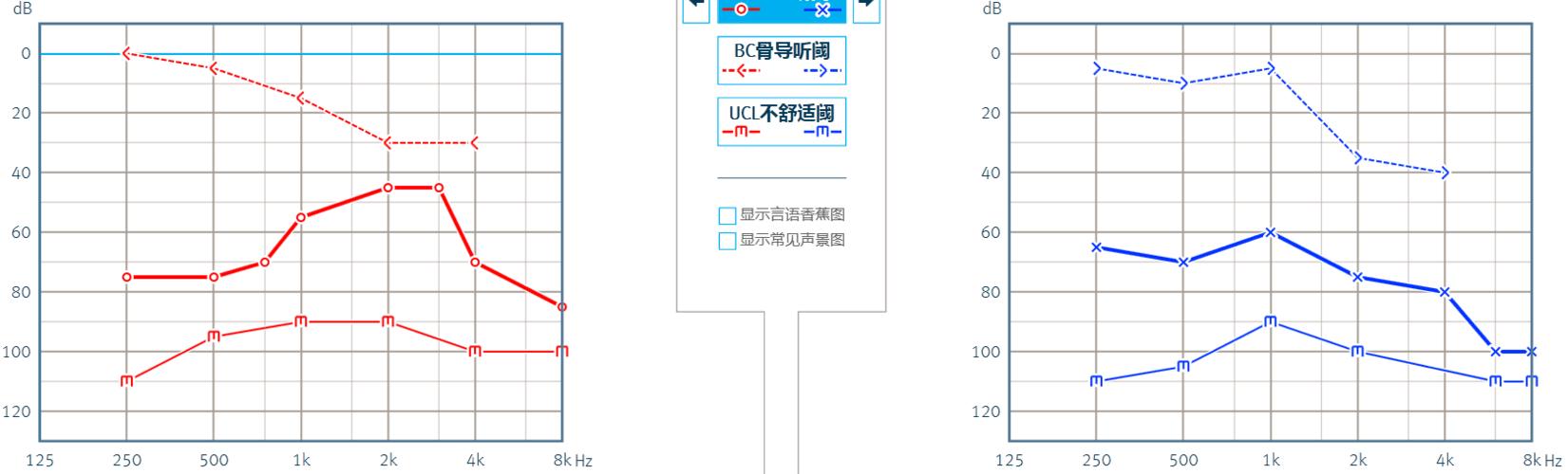 耳朵听不见还是真的充耳不闻--健耳听力高桥店