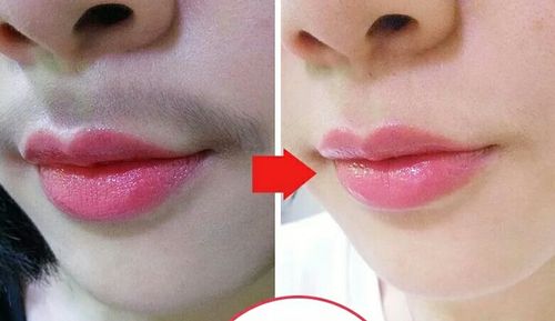 女生长唇毛是怎样的一种体验?