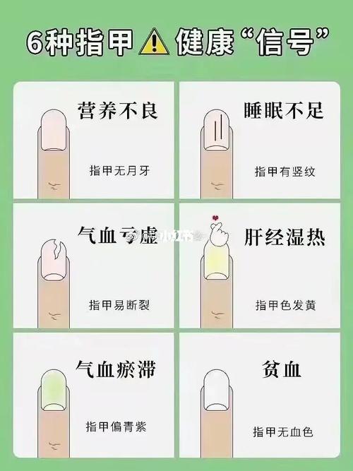 指甲状态可看出6种不同健康状况 99指甲无月牙:身体营养不良_贫血