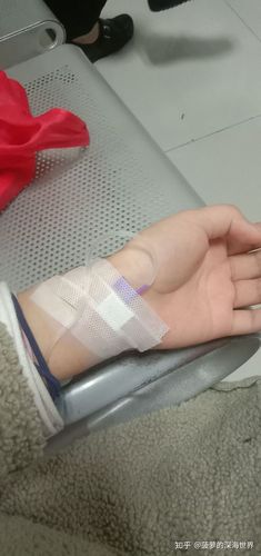 经历了智齿冠周炎的折磨,我来了 在医院输液,护士说我血管太细质量又