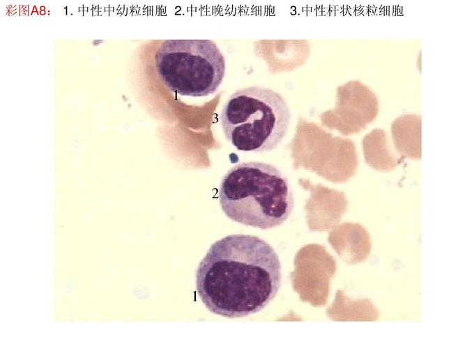 中性晚幼粒细胞 第9页 (共20页,当前第9页) 的相关文档搜索