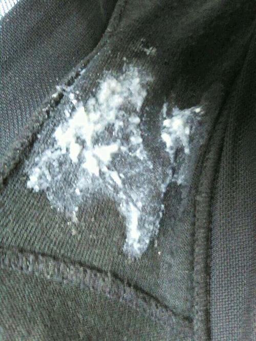 白带主要两点: 白带黄必定有炎症 白带是豆腐渣带痒,可能是霉菌,滴虫