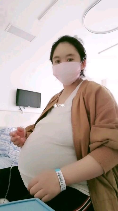 双胞胎足月合体最后一天_双胞胎_母婴_孕产经验