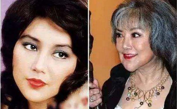 整容失败的三位明星,一位整成蛇精脸,她整到鼻孔都无法呼吸