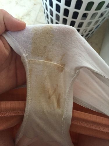 宝妈们帮我看看这是怎么回事 有图慎入(分泌物)