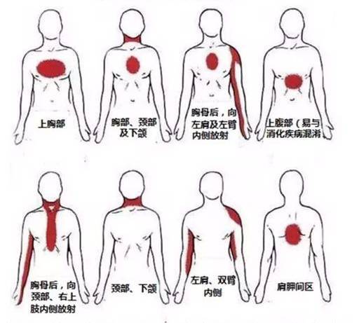 要人命的胸口儿痛,绝不是忍一忍就过去!