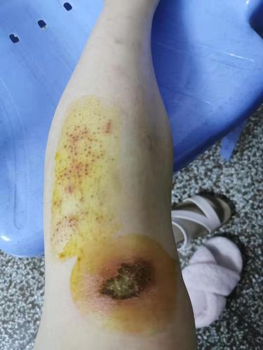 回应: 救救孩子,有姐妹有腿受伤的照片吗?