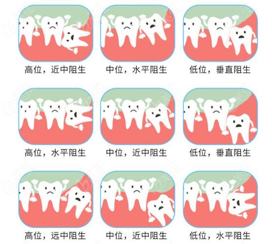 一类是长歪了的智齿拔除费用