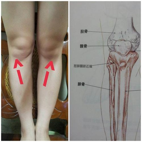 还有很多原因噢~~~~~      髌骨外翻有什麼影响?