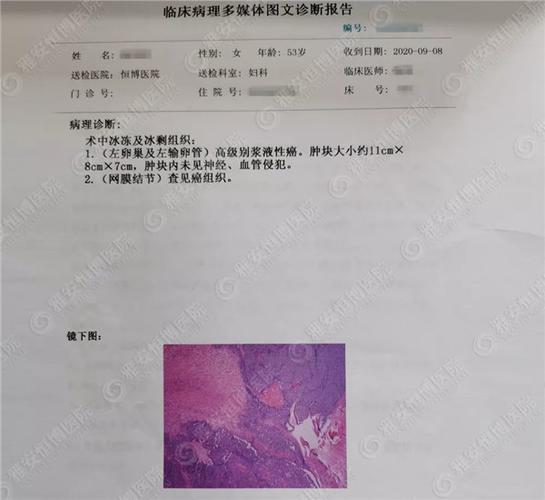 病理检查报告
