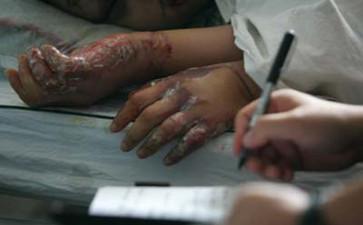 三,艾滋病人常用消毒药物