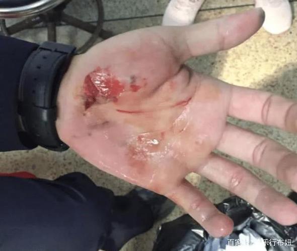 "没发烧,只是喝酒"泉州男子驾车检测体温38度,拖行民警十多米