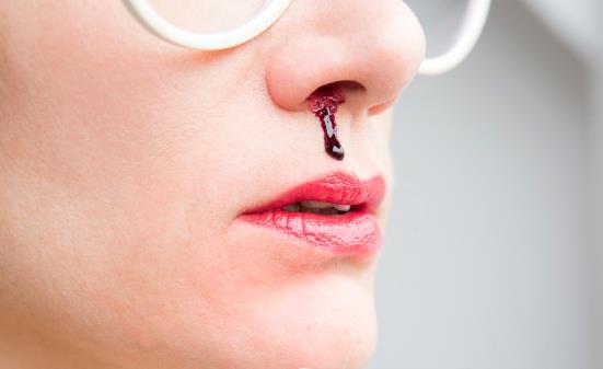 孩子老是流鼻血是什么原因孩子流鼻血该如何处理