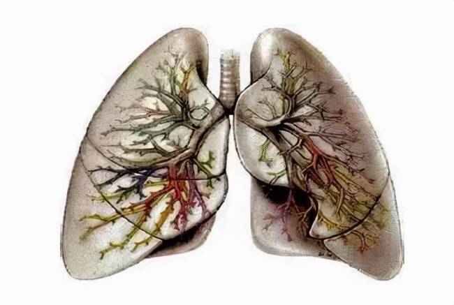13岁女孩喝下百草枯生命进入倒计时专家肺部纤维化不可逆转