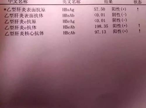 乙肝病毒携带者终身不发病 只是其中一种可能