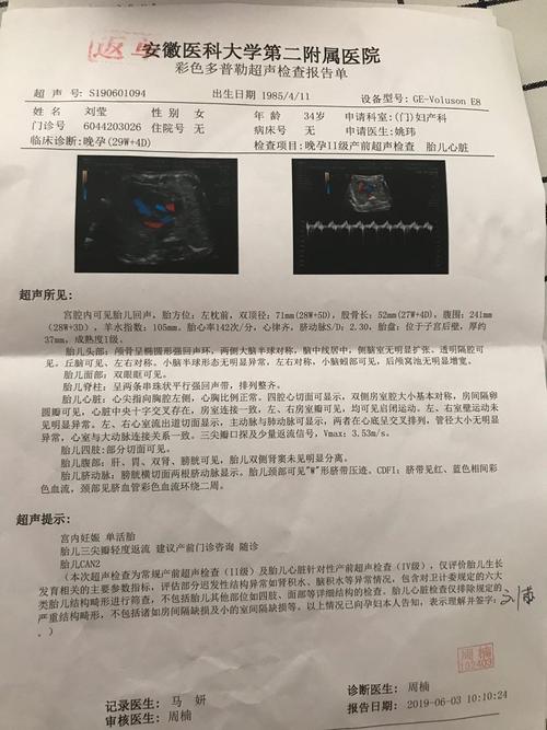 今天去做b超,出现三尖瓣少量返流～具体的