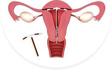 子宫收缩,从而使出血的情况有所改善 温馨提示:上环/取环的最近时间